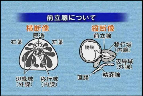 “の”の字2回走査法で出来る! 超音波手技大原則〈第3巻〉 ケアネットDVD