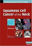 Squamous Cell Cancer of the Neck