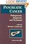 Pancreatic Cancer: Pathogenesis, Diagnosis, and Treatment
