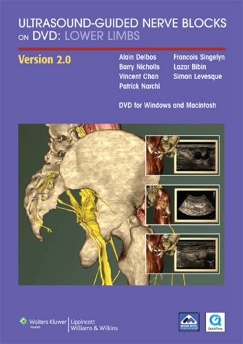 Ultrasound-Guided Nerve Blocks on DVD: Lower Limbs