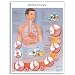 3B Scientific Glossy Paper Gastroesophageal Reflux Disease Anatomical Chart