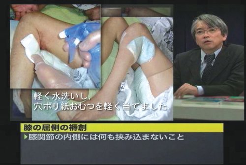Cover image : 褥創治療最前線！Dr.鳥谷部の超ラップ療法 ケアネットDVD