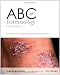 ABC of Dermatology