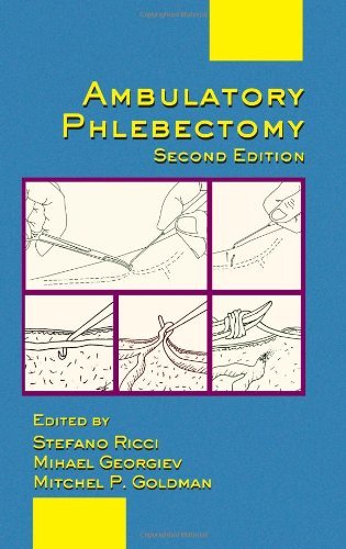 Ambulatory Phlebectomy, Second Edition (Basic and Clinical Dermatology) On Sale