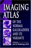 Imaging Atlas of the Normal Gallbladder and Its Variants