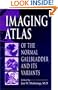 Imaging Atlas of the Normal Gallbladder and Its Variants