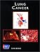 American Cancer Society Atlas of Clinical Oncology: Lung Cancer (Book with CD-ROM)
