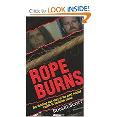 Rope Burns
