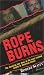 Rope Burns
