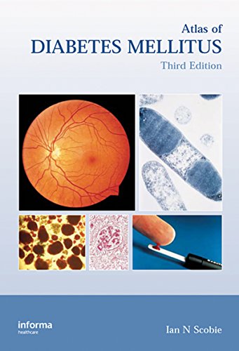 Atlas of Diabetes Mellitus, Third Edition (Encyclopedia of Visual Medicine Series)