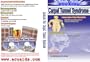 Carpal Tunnel Syndrome treatment from AcuAids