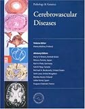 Cerebrovascular Diseases (Pathology & Genetics)
