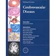 Cerebrovascular Diseases (Pathology and Genetics) by Hannu Kalimo