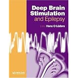 Deep Brain Stimulation and Epilepsy