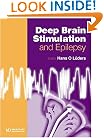Deep Brain Stimulation and Epilepsy