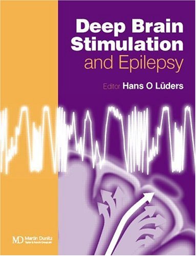 Epilepsy