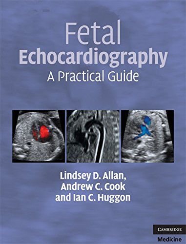 Fetal Echocardiography: A Practical Guide by Lindsey D. Allan (2-Jul-2009) Hardcover