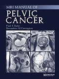 Handbook of Mri Staging of Pelvic Cancer