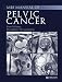 MRI Manual of Pelvic Cancer