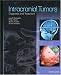 Books : Intracranial Tumors of the Central Nervous System: Diagnosis and Treatment