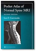 Pocket Atlas of Spinal MRI (Radiology Pocket Atlas Series)
