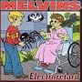 Electroretard