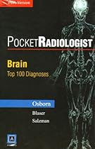 Pocket Radiologist Brain: Top 100 Diagnosis PDA