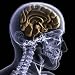 Skeleton X-ray - Half a Mind - 24H x 24W - Peel and Stick Wall Decal by Wallmonkeys
