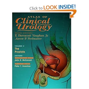 Click here to buy The Prostate (Atlas of Clinical Urology, V. 2) by John D. McConnell and Peter T. Scardino.