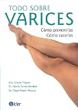 Todo sobre varices / Everything about Varicose Veins: Como prevenirla, Como curarla/ How to prevent them, How to cure them (Coleccion Todo Sobre--) (Spanish Edition)