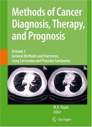 Methods of Cancer Diagnosis, Therapy and Prognosis: 2