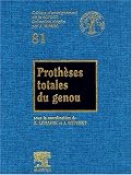 Prothèses totales du genou Prothèses totales du genou