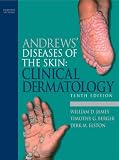 Andrews Diseases of the Skin: Clinical Dermatology