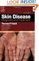 Skin Disease: Diagnosis and Treament