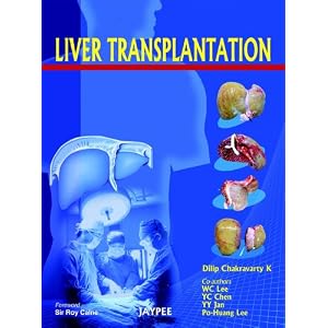 Click here to buy Liver Transplantation by Chakravarty.