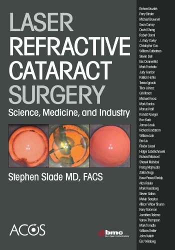 Laser Refractive Cataract Surgery: Science, Medicine, and Industry