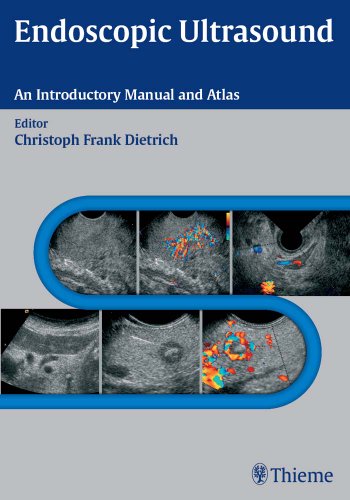 Endoscopic Ultrasound: An Introductory Manual and Atlas