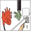 Heartbeeps