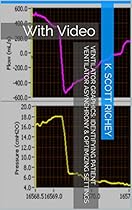 Ventilator Graphics: Identifying Patient Ventilator Asynchrony & Optimizing Settings: With Video Ventilator Graphics: Identifying Patient Ventilator Asynchrony & Optimizing Settings: With Video