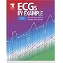 ECGs by Example