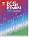 Books : ECGs by Example