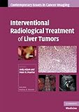 Interventional radiological treatment of liver tumors
