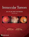Intraocular tumors : an atlas and textbook