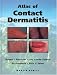 An Atlas of Contact Dermatitis