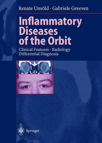 Inflammatory Diseases of the Orbit: Clinical Features, Radiology, Differential Diagnosis