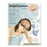 Understanding Depression Anatomical Chart