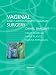 Search : Vaginal and Laproscopic Vaginal Surgery
