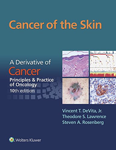 Cancer of the Skin: Cancer: Principles & Practice of Oncology