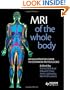 MRI of the Whole Body