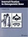 Book Internal Fixation In Osteoporotic Bone